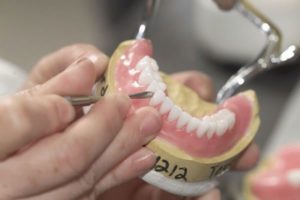 Image - DIY dental bridge repair