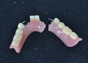 Image - DIY dental bridge repair