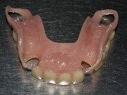Image - DIY dental bridge repair