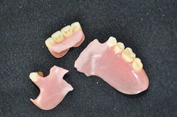 Image - DIY dental bridge repair