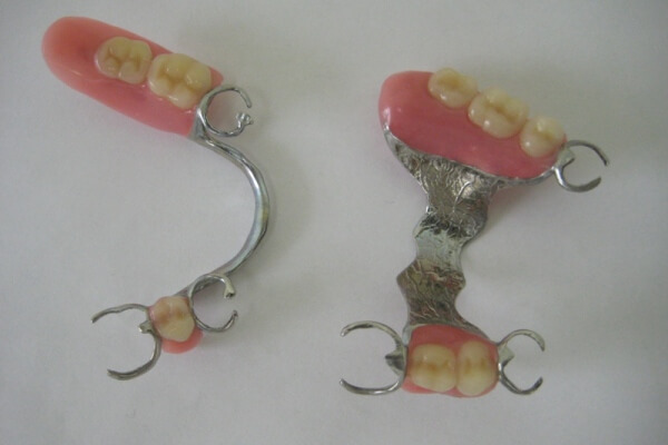 Image - DIY dental bridge repair