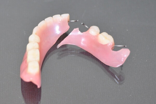 Image - DIY dental bridge repair