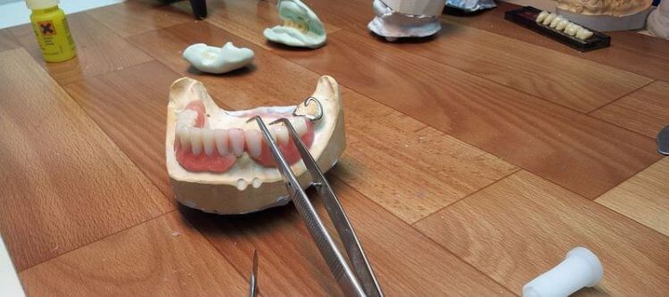 Image - DIY dental bridge repair